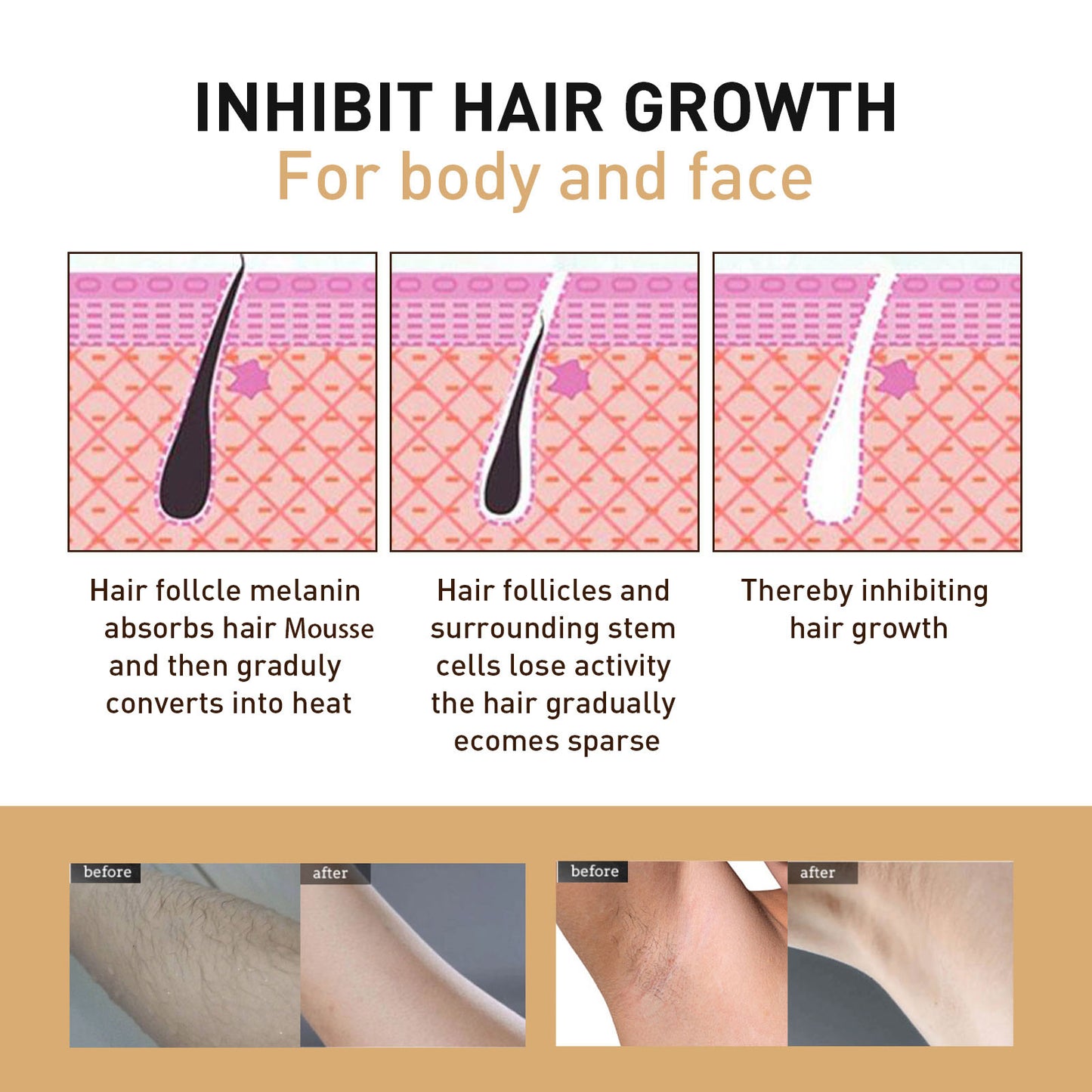 Seurico™ BeeSilk Hair Removal Mousse(Best selling💥)