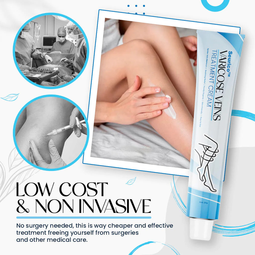 Seurico™ Varicose Veins Treatment Cream