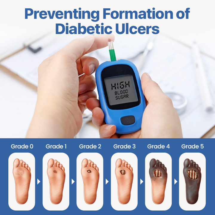 DiabeHeal™ Diabetic Skin Treatment Cream