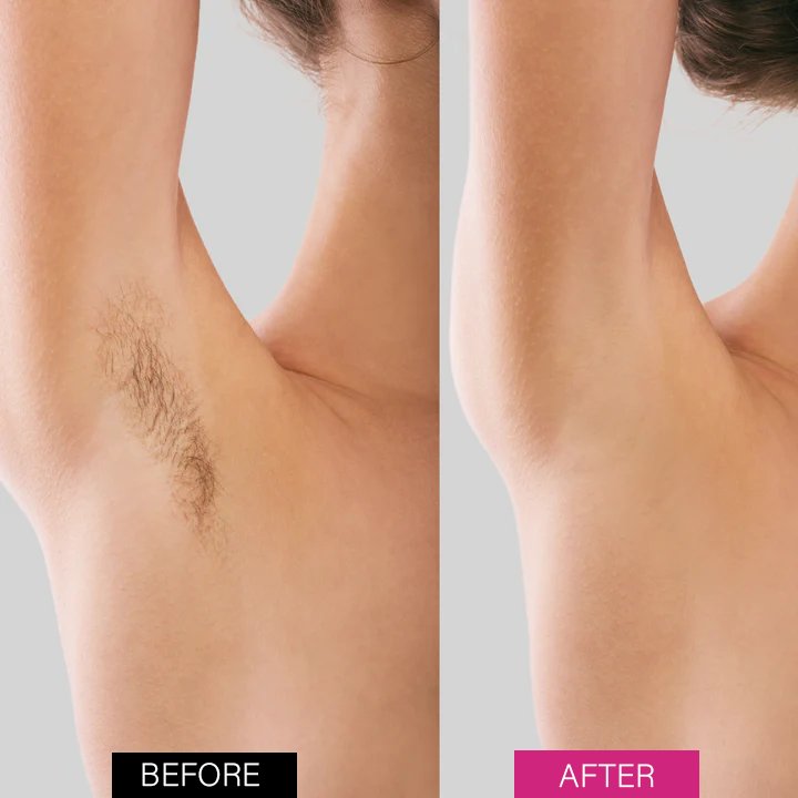 Seurico™ BeeSilk Hair Removal Mousse(Best selling💥)