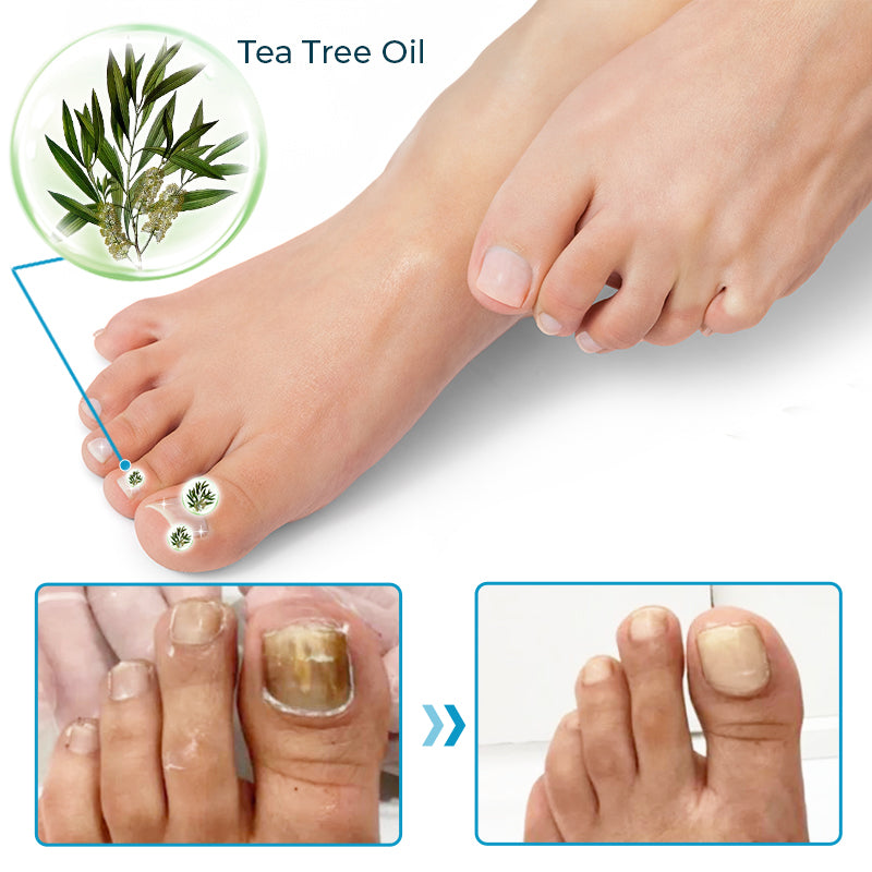 SEURICO™ Bee Venom Deep Repair Nail Essence 🐝✨ | Powerful Antifungal & Nail Strengthening Solution 💪🌱