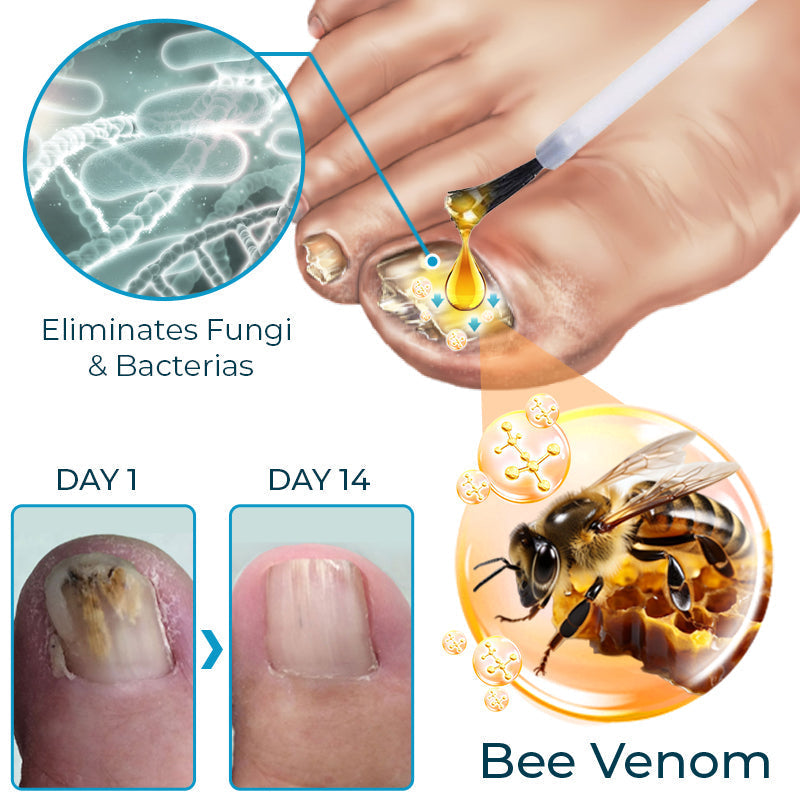SEURICO™ Bee Venom Deep Repair Nail Essence 🐝✨ | Powerful Antifungal & Nail Strengthening Solution 💪🌱