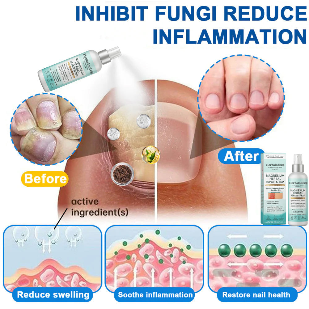 🌿 Herbalonix® Official Store Magnesium Herbal Repair Spray