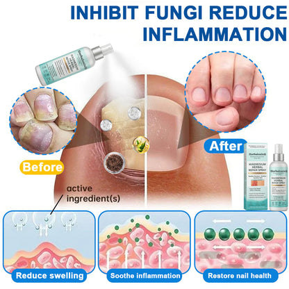 🌿 Herbalonix® Official Store Magnesium Herbal Repair Spray