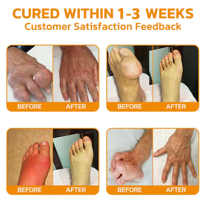 ✅ Official Store: SEURICO™ Bee Venom Joint Repair Cream 👨‍⚕️ American Orthopaedic Association (AOA) Approved (Reduces joint swelling, pain, stiffness, redness, warmth, soreness, and joint fatigue).